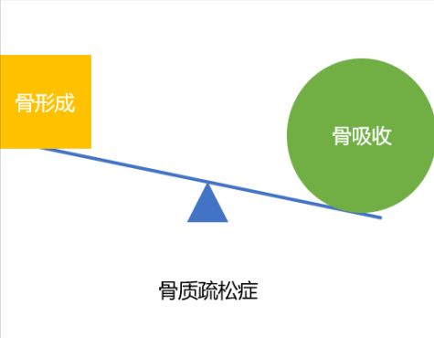 一生中骨流失总量可达50%：骨质疏松症防治，莫待银发之时