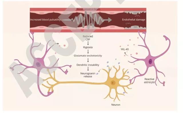 脑科学日报：如何突破血脑屏障？Omega-3可能是关键