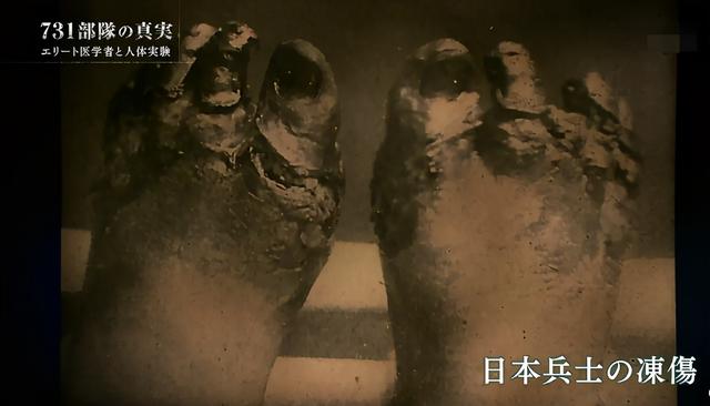 细数日本731部队的残忍实验，几十万同胞惨死，场面不忍直视