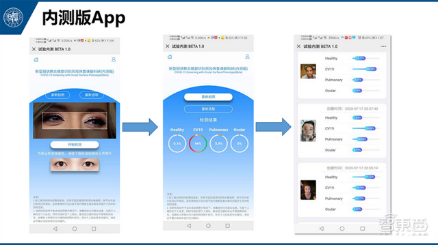 自拍眼睛就能测新冠！这项AI技术国内免费开放，3秒获诊断结果