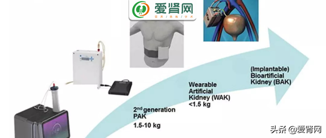 最全汇总！各类人工肾，临床应用要多久？