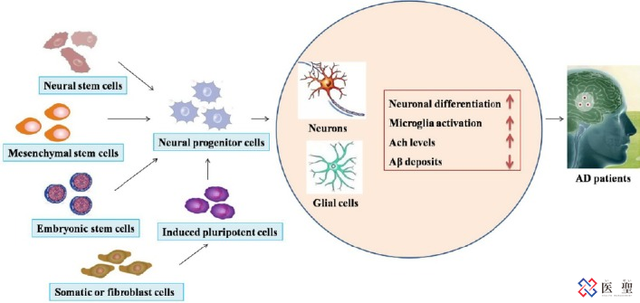 每年的增加的痴呆症患者，干细胞治疗老年痴呆症