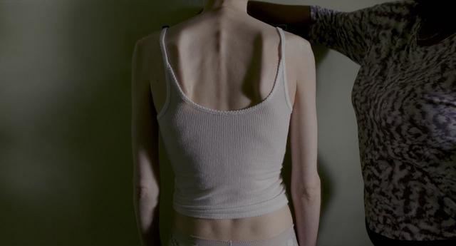 社交媒体加剧青春期女孩的进食障碍，这是一个公共卫生问题