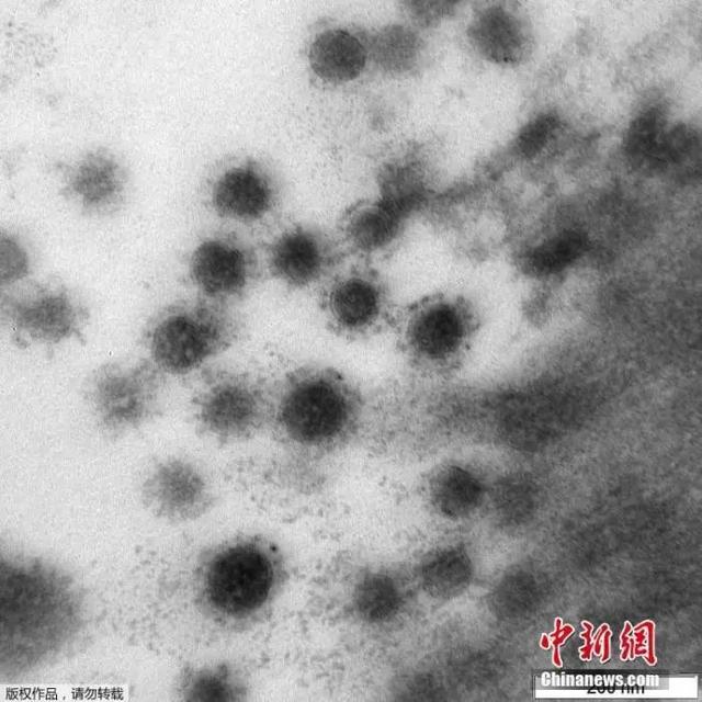 又一新冠变异毒株来袭，比德尔塔还可怕？