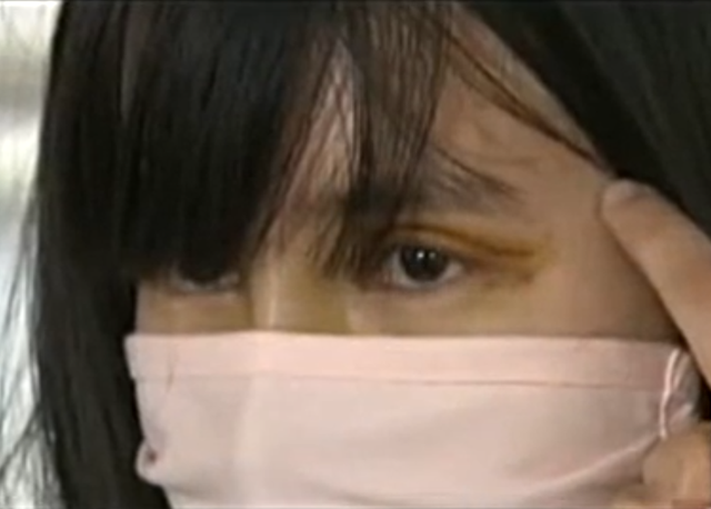 故事：云南母女俩去整容，一场割眼袋的“小”手术，她们天人永隔