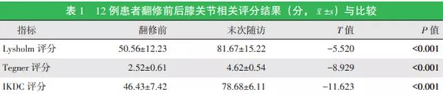 临床技术 | 分期植骨翻修重建治疗前交叉韧带重建失败伴骨隧道扩大