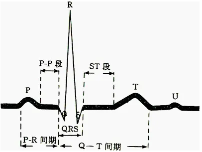 塑心学堂 | 什么是心电图报告ST段异常？