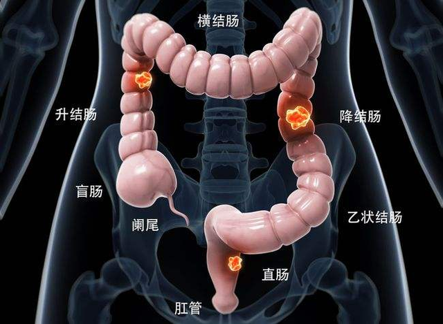 德国病理学之父：炎症是癌症的祸根，身体有这3种炎症不要拖