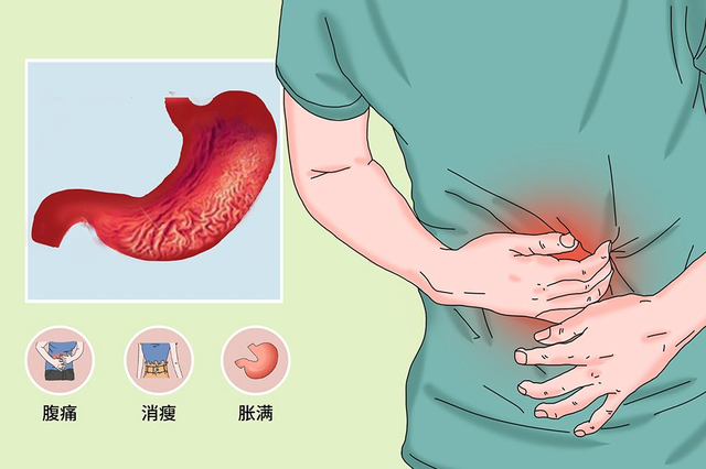 德国病理学之父：炎症是癌症的祸根，身体有这3种炎症不要拖