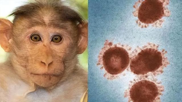 11个国家发现80多例猴痘，中国是否需要补种天花疫苗？
