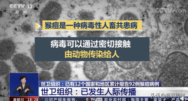 良医 | 猴痘的这种传播途径值得重视