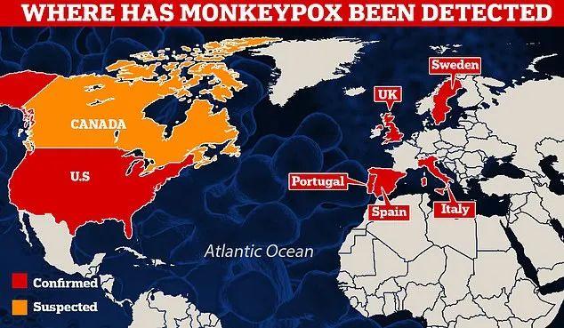 多国拉响猴痘疫情警报！我们应该如何预防？