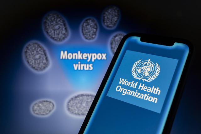 猴痘疫情预警！世卫：大型聚会有感染风险 比利时：患者自我隔离21天 英国：密接者隔离三周