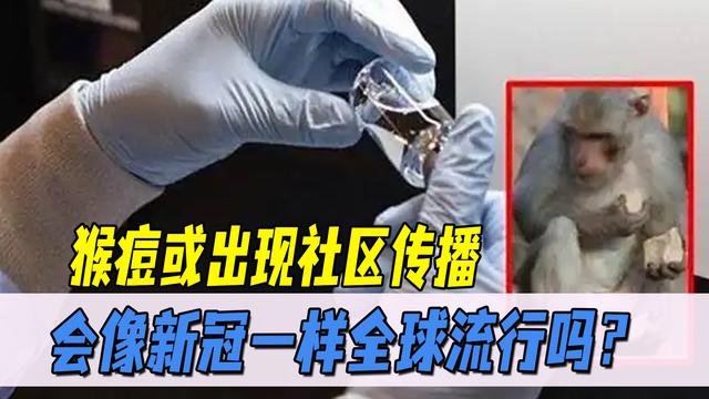 猴痘大面积爆发，会成为第二个新冠吗？跟美国实验室猴子有关吗？