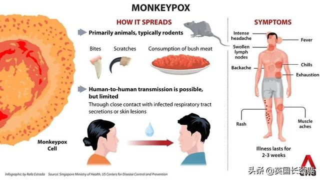猴痘会成为全球流行病吗？英国建议猴痘高风险人群隔离3周