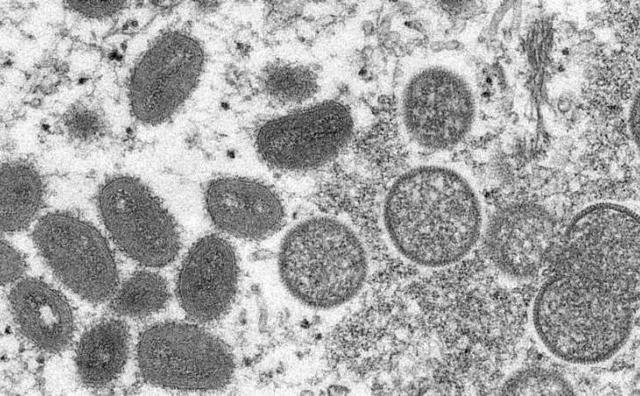 【卫生检疫】猴痘突袭来 国人需警惕