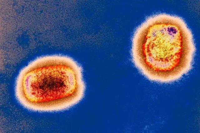 欧美多国现罕见猴痘病例，会成为下一个大流行病吗？