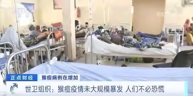 新冠病毒还没消灭，猴痘病毒又来了？医生提醒：致死率可达10%