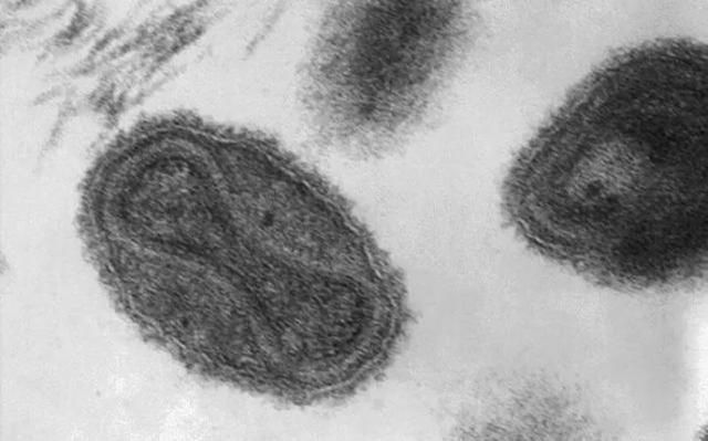 11个国家发现80多例猴痘，中国是否需要补种天花疫苗？