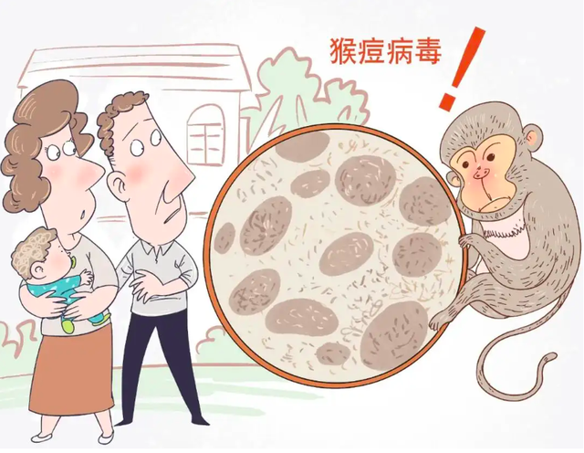 中国台湾出现首例猴痘病例，最全最易懂科普与防护建议