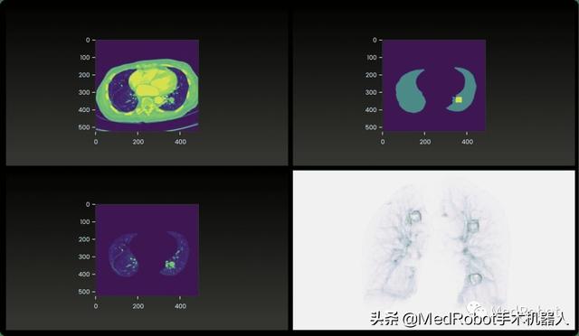 微创投资的新加坡机器人公司 | 盘点12