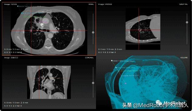 微创投资的新加坡机器人公司 | 盘点12