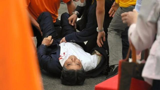 安倍为何如此轻易遇刺身亡？