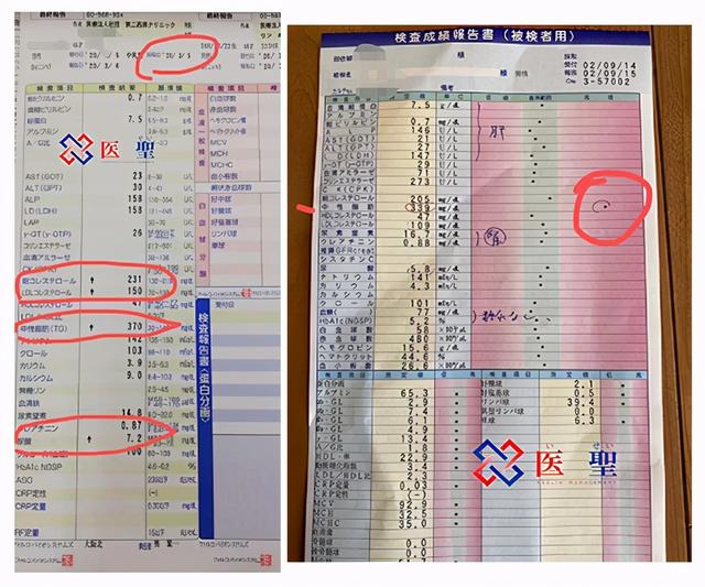 isei 日本干细胞：痛风正在悄悄地侵袭，干细胞治疗痛风