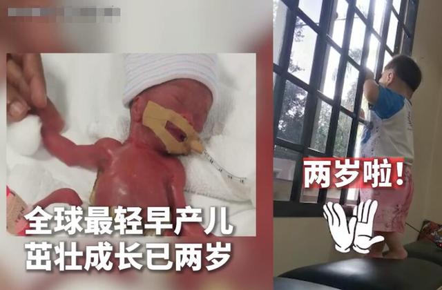 全球最小新生儿在新加坡已两岁啦！太棒啦