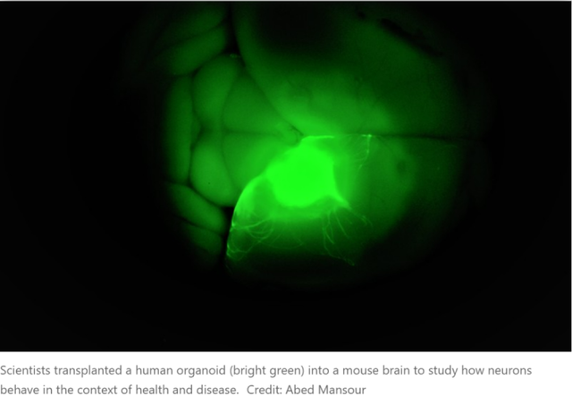 脑科学日报：类器官开发—将人类细胞移植到动物大脑