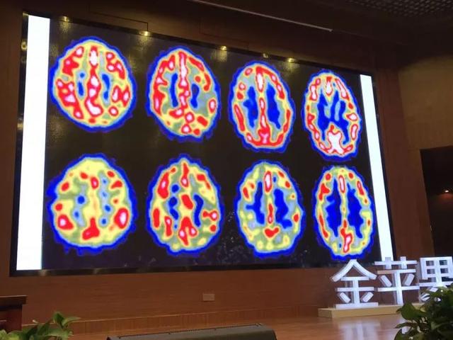 脑科学专家：发展孩子大脑最好的三个方法，运动、阅读和游戏