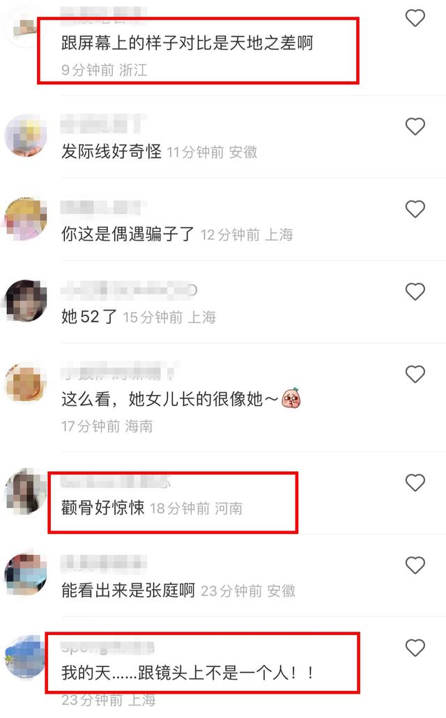 52岁张庭现身新加坡，无滤镜素颜曝光，秃头憔悴苍老像变了一个人