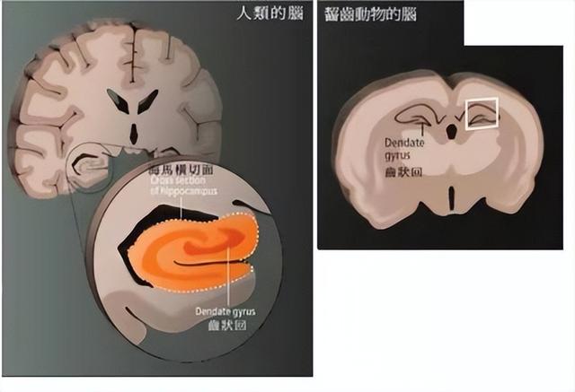 脑科学专家：发展孩子大脑最好的三个方法，运动、阅读和游戏