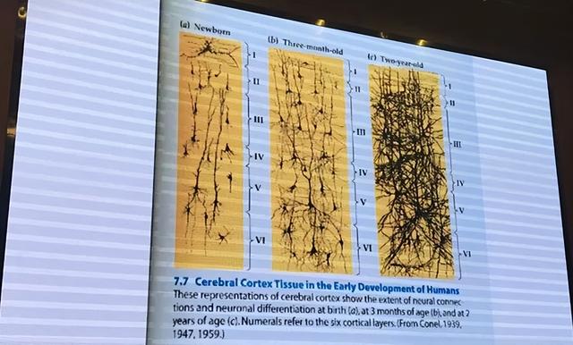 脑科学专家：发展孩子大脑最好的三个方法，运动、阅读和游戏