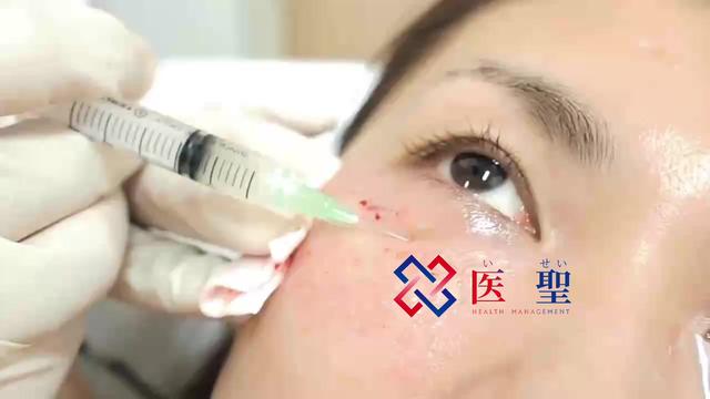 isei 日本干细胞：如何抵抗脸部老化 日本纤维芽细胞再生医疗
