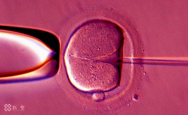 isei 日本干细胞：男性和女性不孕不育的原因有哪些？