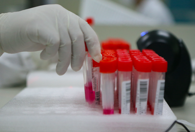 高传染性和致死率的“地狱犬”在日本“杀疯”？警惕“谣言变异株”兴风作浪