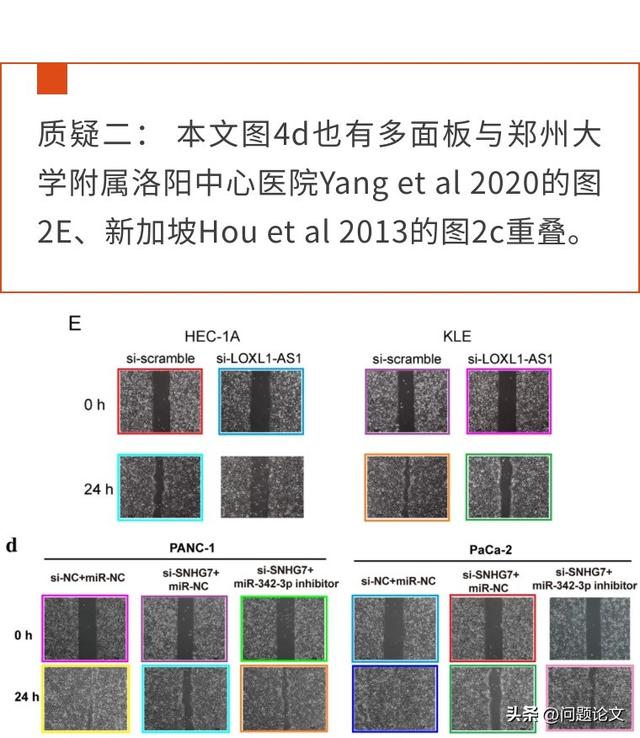 上海瑞金医院高分论文竟与新加坡的文章图片一致，后者早发表6年