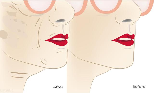 isei 日本干细胞：什么是面部抗衰老方式？ 从细胞层面解决皱纹 下垂