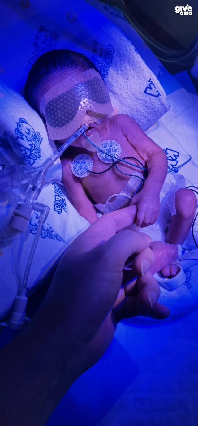 从中国外派新加坡，没想到宝宝早产面临着天价医药费